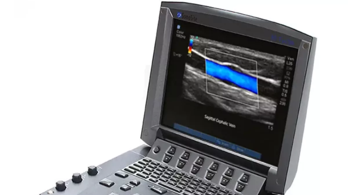 Portable Ultrasound Service and Repair
